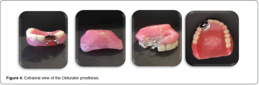 Click here to view Large Figure 4