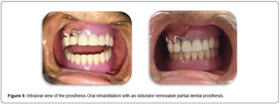 Click here to view Large Figure 5