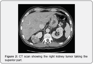 Click here to view Large Figure 2