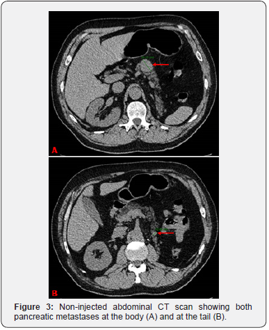 Click here to view Large Figure 3