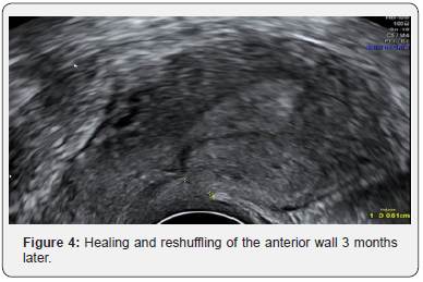 Click here to view Large Figure 4