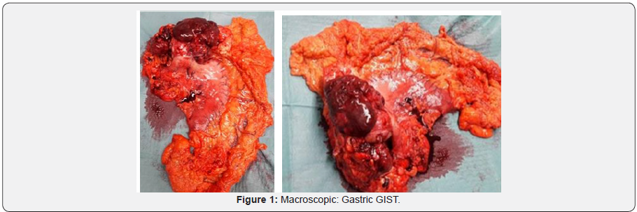 Click here to view Large Figure 1