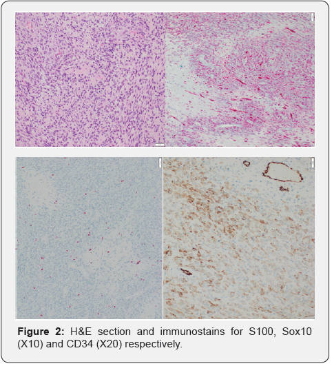 Click here to view Large Figure 2