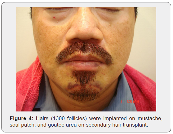 Click here to view Large Figure 4