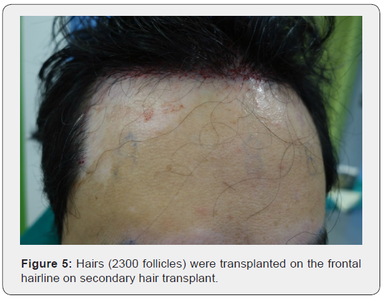 Click here to view Large Figure 5