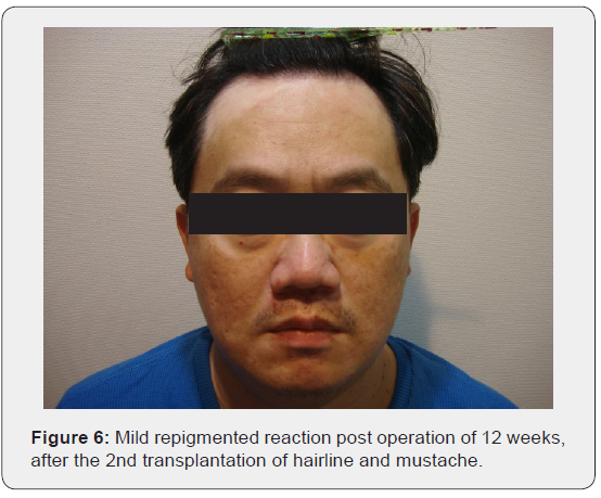 Click here to view Large Figure 6