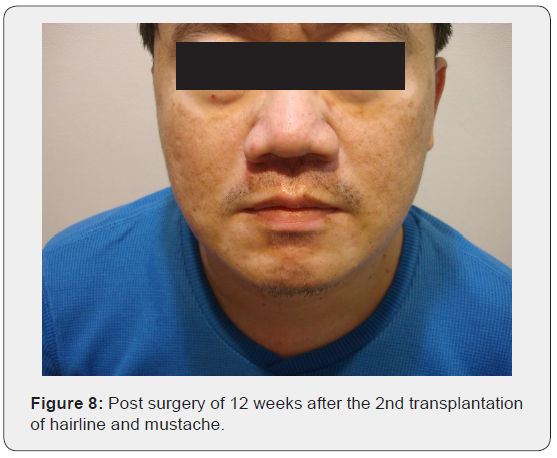 Click here to view Large Figure 8