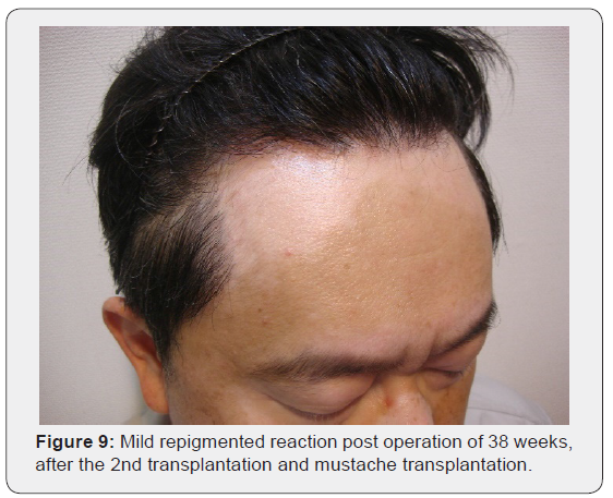 Click here to view Large Figure 9