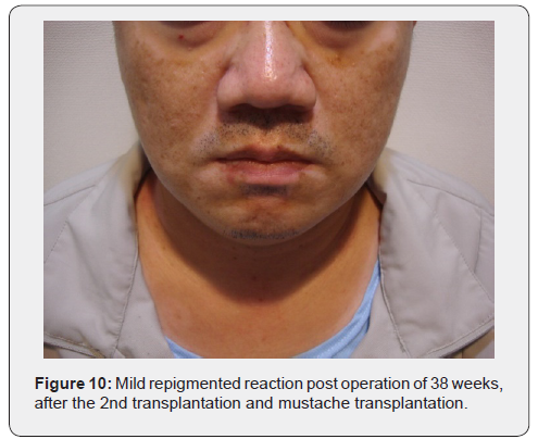 Click here to view Large Figure 10