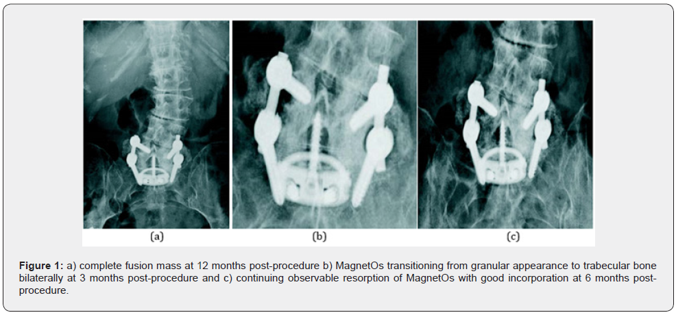 Click here to view Large Figure 1