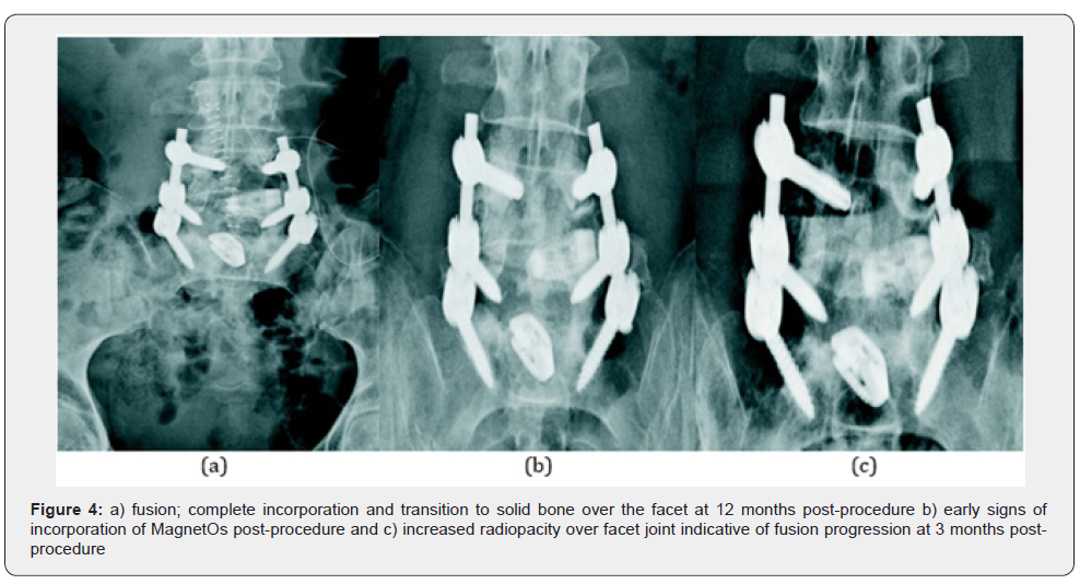 Click here to view Large Figure 4
