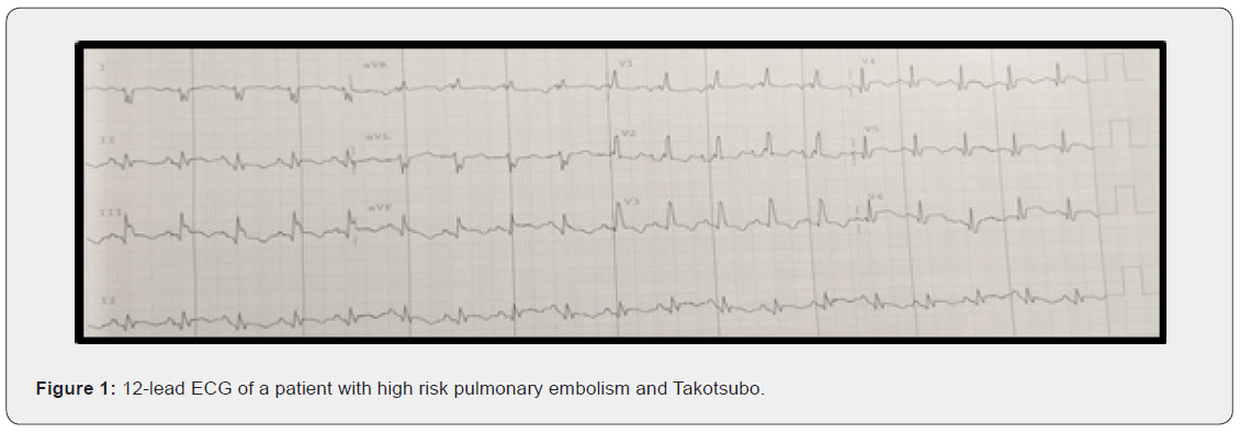 Click here to view Large Figure