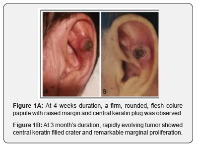 Click here to view Large Figure 1a