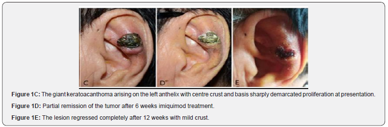 Click here to view Large Figure 1c