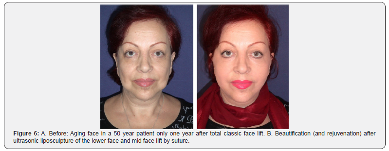 Click here to view Large Figure 6