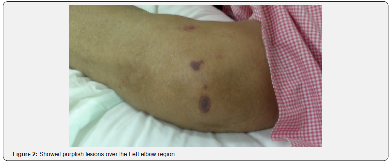 Click here to view Large Figure 2