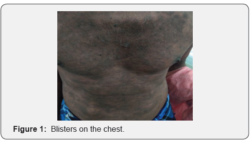 Click here to view Large Figure 1 JOJ Dermatology & Cosmetics