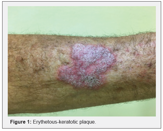 Click here to view Large Figure 1 JOJ Dermatology & Cosmetics