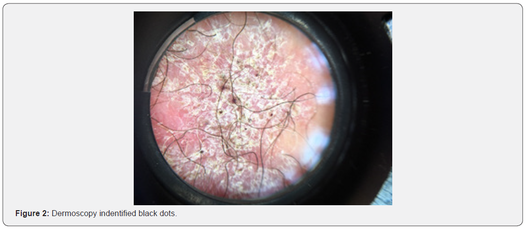 Click here to view Large Figure 2 JOJ Dermatology & Cosmetics