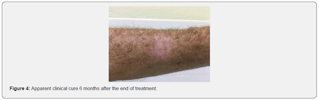 Click here to view Large Figure 4 JOJ Dermatology & Cosmetics