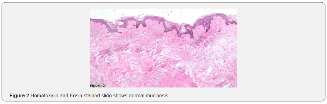 Click here to view Large Figure 2 JOJ Dermatology & Cosmetics