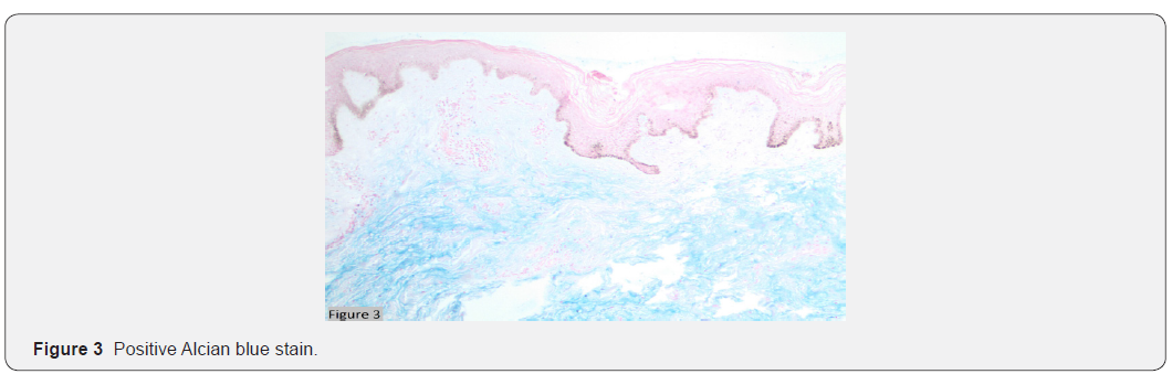 Click here to view Large Figure 3 JOJ Dermatology & Cosmetics