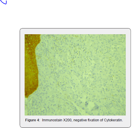 Click here to view Large Figure 4 JOJ Dermatology & Cosmetics