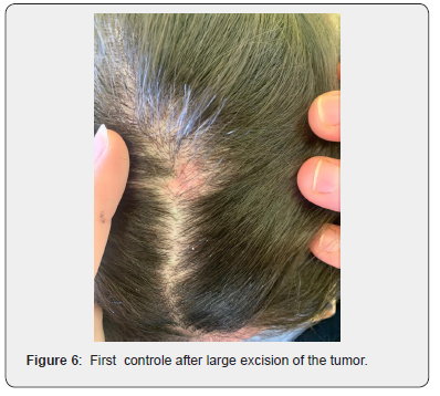 Click here to view Large Figure 6 JOJ Dermatology & Cosmetics