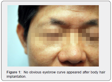 Click here to view Large Figure 1 JOJ Dermatology & Cosmetics