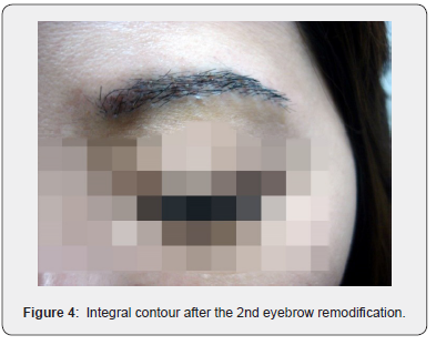 Click here to view Large Figure 4 JOJ Dermatology & Cosmetics