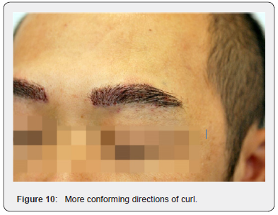 Click here to view Large Figure 10 JOJ Dermatology & Cosmetics