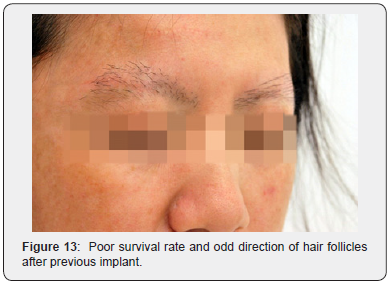 Click here to view Large Figure 13 JOJ Dermatology & Cosmetics