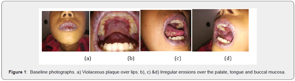 Click here to view Large Figure 1 JOJ Dermatology & Cosmetics