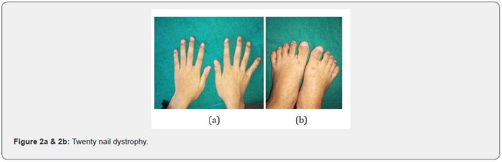 Click here to view Large Figure 2 JOJ Dermatology & Cosmetics