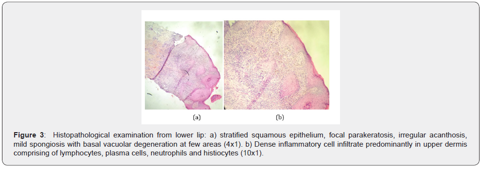 Click here to view Large Figure 3 JOJ Dermatology & Cosmetics