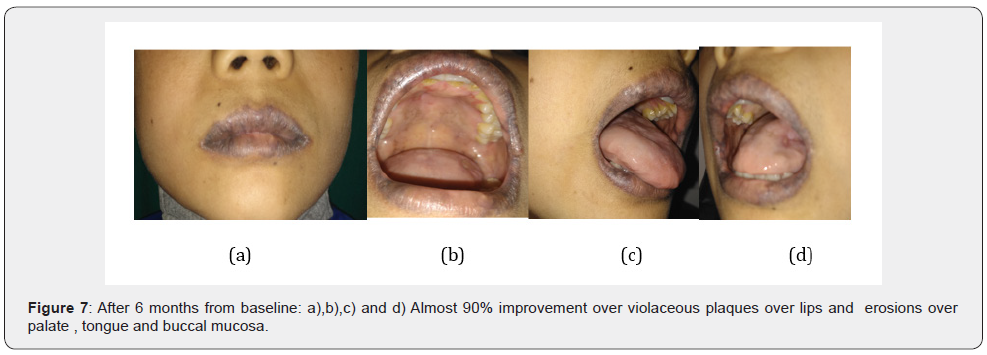 Click here to view Large Figure 7 JOJ Dermatology & Cosmetics