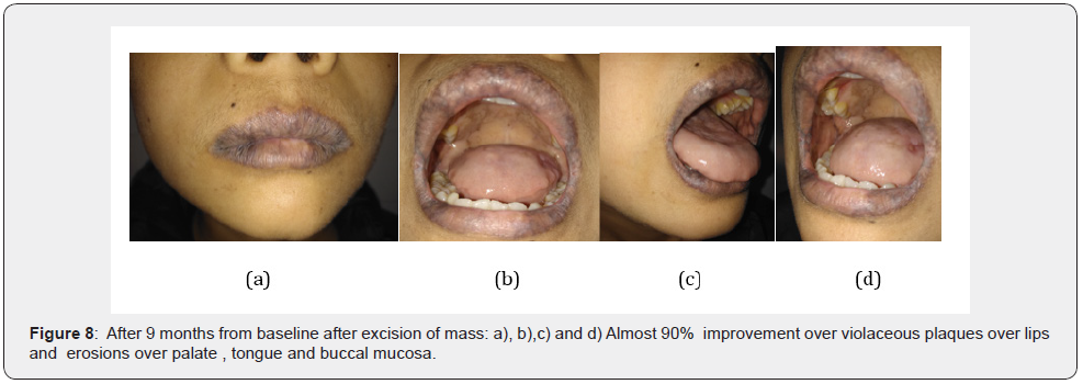 Click here to view Large Figure 8 JOJ Dermatology & Cosmetics