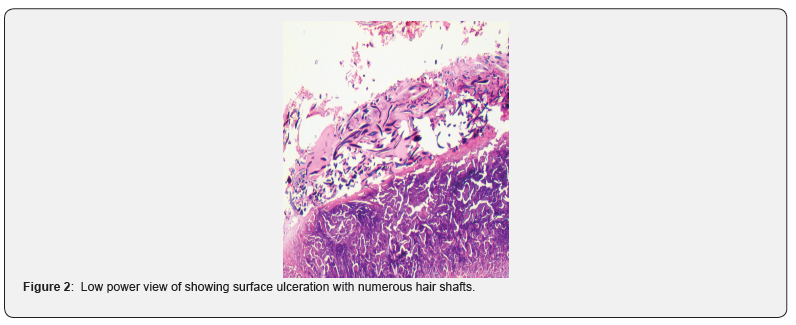 Click here to view Large Figure 2 JOJ Dermatology & Cosmetics