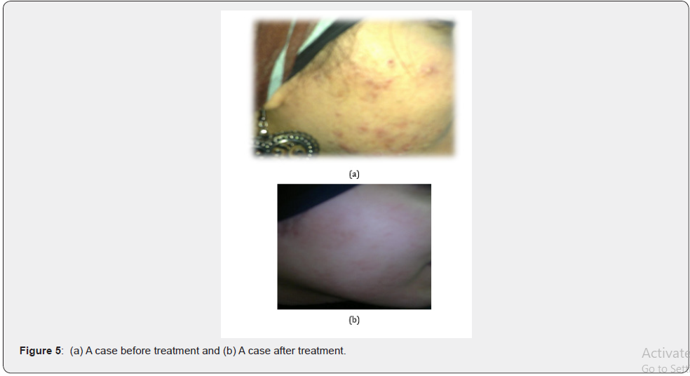 Click here to view Large Figure 5 JOJ Dermatology & Cosmetics