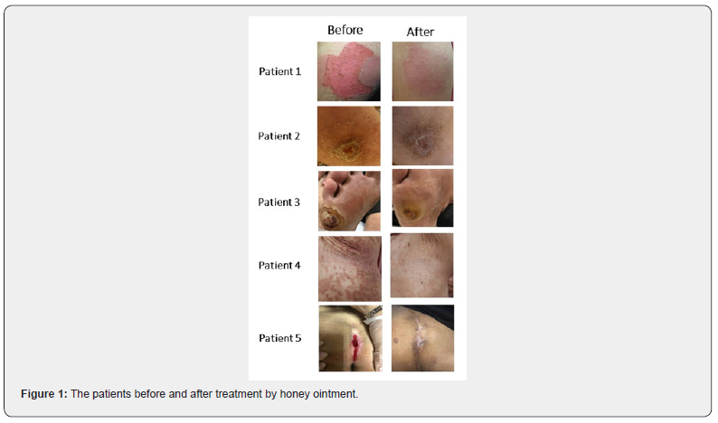 Click here to view Large Figure 1