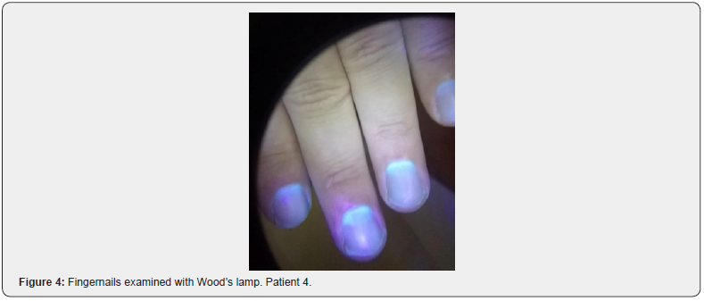 Click here to view Large Figure 4