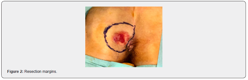 Click here to view Large Figure 2