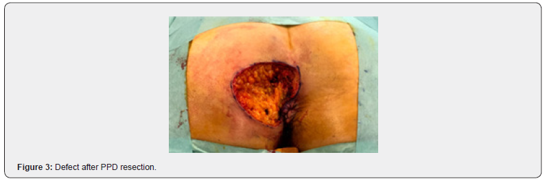 Click here to view Large Figure 3