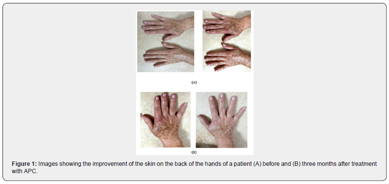 Click here to view Large Figure 1