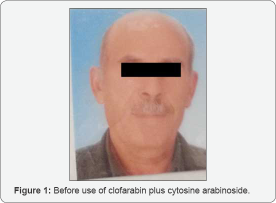 Click here to view Large Figure 1