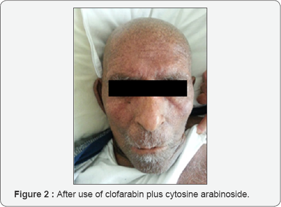 Click here to view Large Figure 2