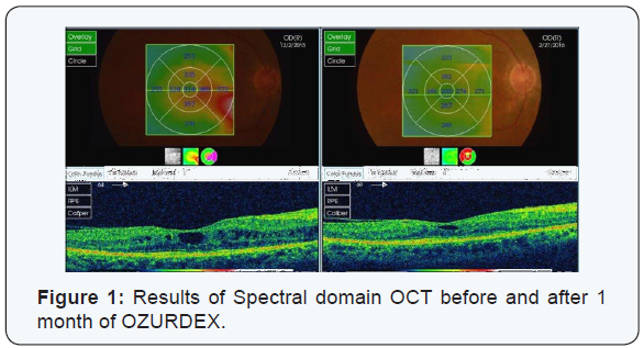 Click here to view Large Figure 1