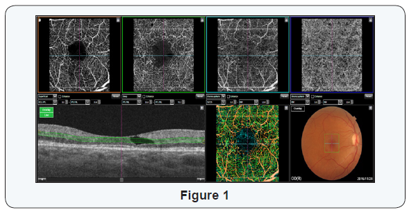 Click here to view Large Figure 1
