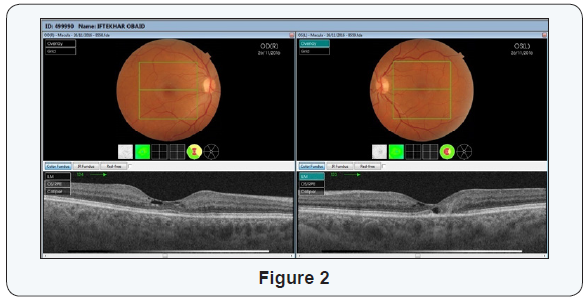 Click here to view Large Figure 2