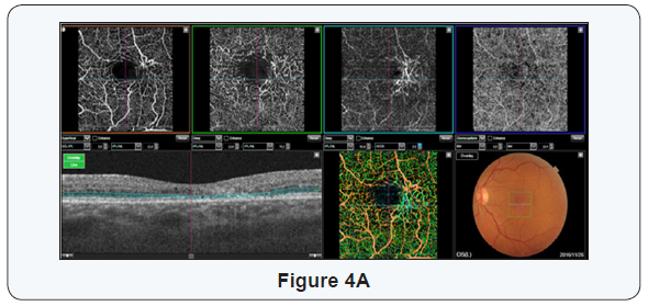 Click here to view Large Figure 4A
